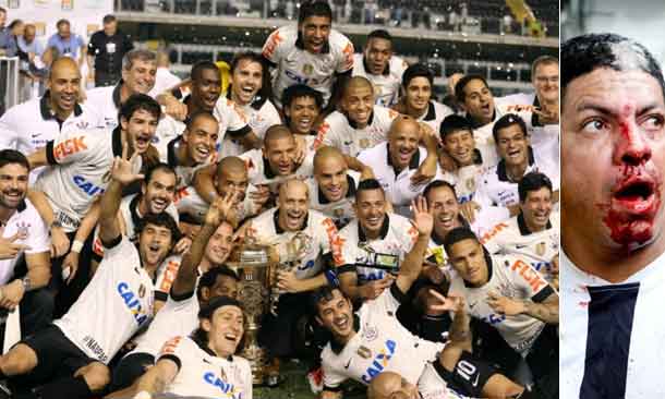 Montagem/R7