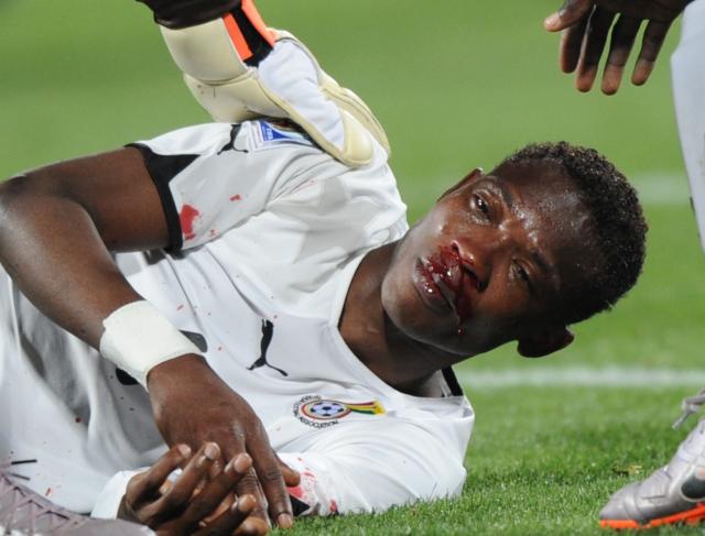 O zagueiro Johm Paintsil, de Gana, cai no gramado sangrando depois de um choque com o atacante Josh Kennedy, da Austrália...